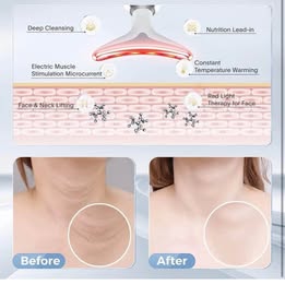 ES-1081 Intense Pulsed Light Wrinkles Reducing Instrument - Anti-Aging Beauty Device